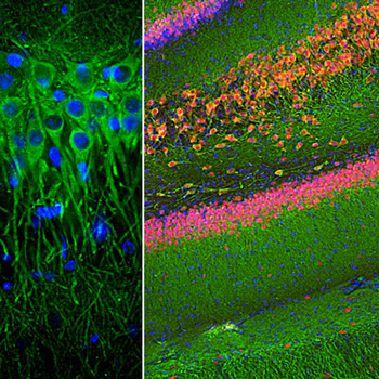 Microtubule Associated Protein 2 (MAP2) Antibody