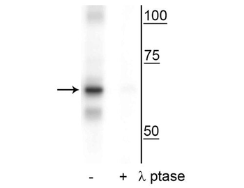 NF-kB p65 (Ser316) Antibody