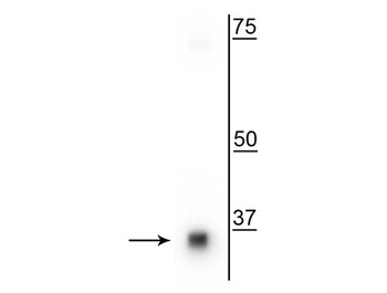 Survival Motor Neuron (SMN) Antibody