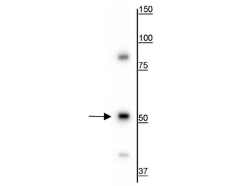 Vimentin Antibody