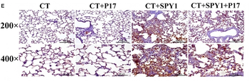 TGFB1 Antibody