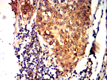 TGFB1 Antibody