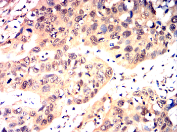 TJP1 Antibody