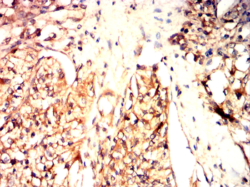 TJP1 Antibody