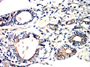 TJP1 Antibody