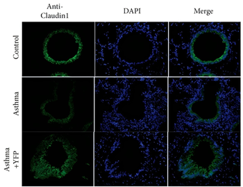 TJP1 Antibody