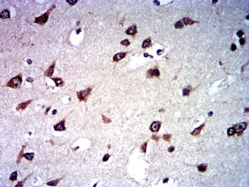 PIK3R1 Antibody