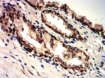 PIK3R1 Antibody
