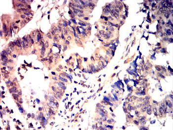 PIK3R2 Antibody