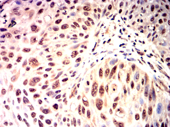 PIK3R2 Antibody