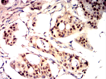 PIK3R2 Antibody