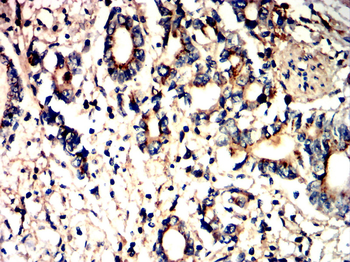 PIK3R2 Antibody