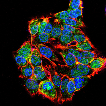PIK3R1 Antibody