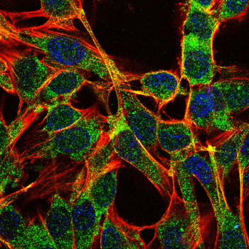 PIK3R1 Antibody