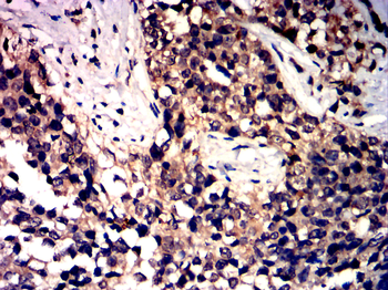 NOS2 Antibody