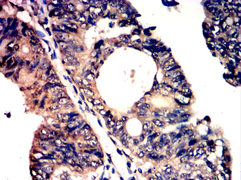 NOS2 Antibody