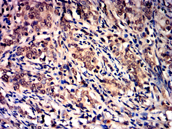 NFE2L2 Antibody
