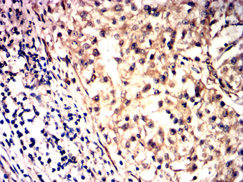 NFE2L2 Antibody