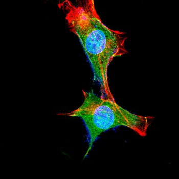 MMP2 Antibody