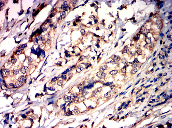 MMP2 Antibody