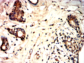 MMP2 Antibody