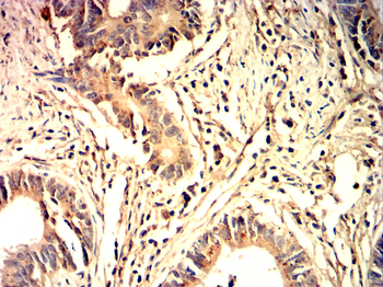 NLRP3 Antibody