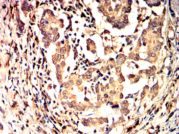 NLRP3 Antibody