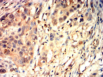 NLRP3 Antibody