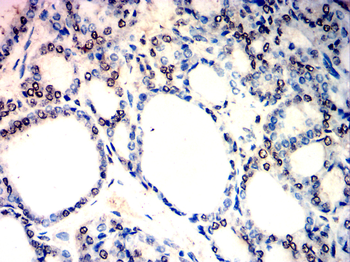 CCND1 Antibody