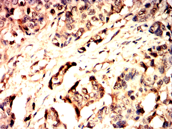 PPARGC1A Antibody