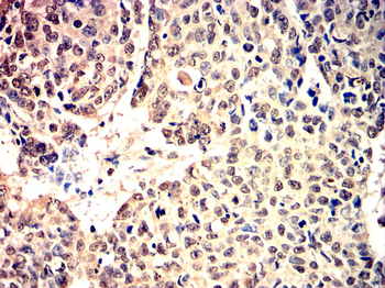 PPARGC1A Antibody