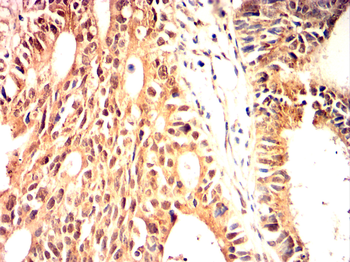 PPARGC1A Antibody