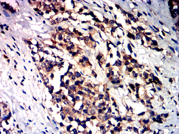 CDKN1A Antibody
