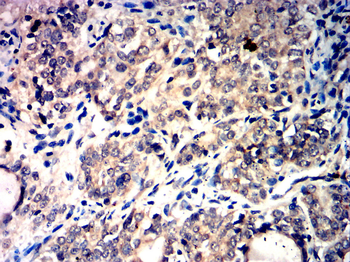 CDKN1A Antibody