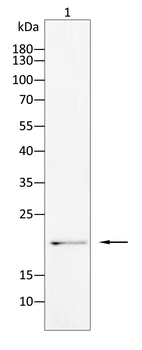 CDKN1A Antibody