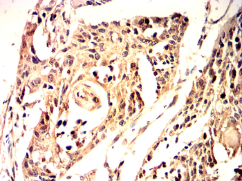 PPARG Antibody