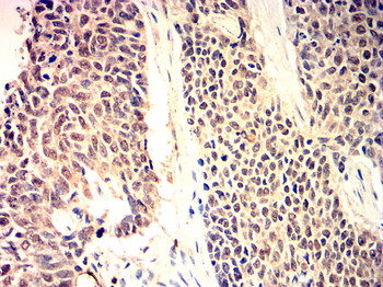 PPARG Antibody