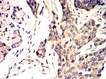 RUNX1+RUNX2+RUNX3 Antibody