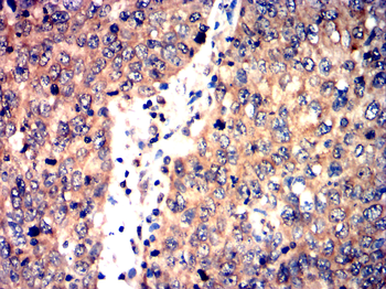 RUNX1+RUNX2+RUNX3 Antibody