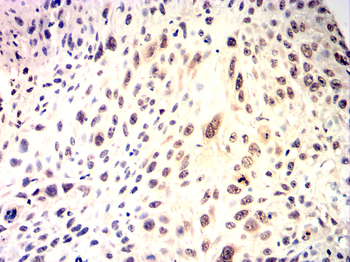 RUNX1+RUNX2+RUNX3 Antibody