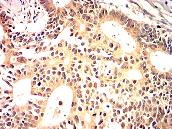 MYC Antibody
