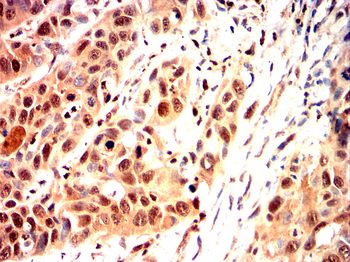 NLRP3 Antibody