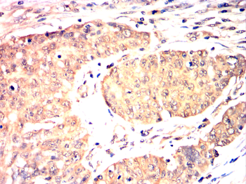NLRP3 Antibody