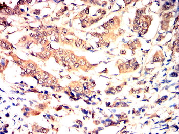 NLRP3 Antibody