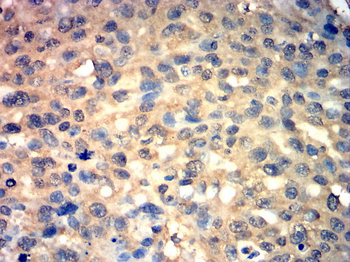 PPARA Antibody
