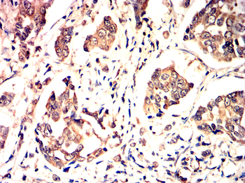HSPA5 Antibody