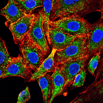 GFAP Antibody