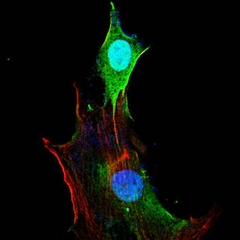 NQO1 Antibody