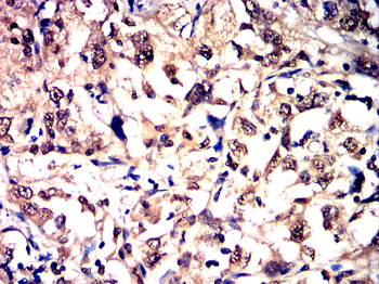DDIT3 Antibody