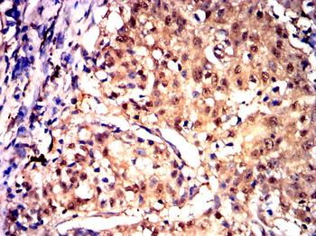DDIT3 Antibody